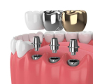 Dental Clinic In Madurai