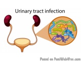 urinary tract infection causes