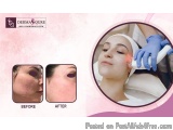The image is a before and after comparison of a facial treatment. On the left side of the image, there is a close-up of a wom...