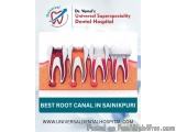 Top Reasons to Choose a Root Canal Specialist Over a General Dentist