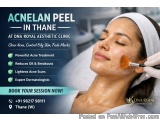 Acnelan Chemical Peel in Thane at DNA Royal | Targeted Treatment for Acne & Oily Skin