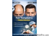 Effective Hair Transplant Solutions in Thane for Thinning Hair