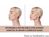 The image is a side-by-side comparison of a woman's face before and after a chin surgery procedure in Jaipur, India. On the l...