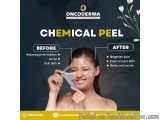 Revive Your Skin with Expert Dermatology Care in Yelahanka - Oncodermacentre.com