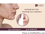 Effective Acne Scar Treatment Options In Bangalore - Dermaqure