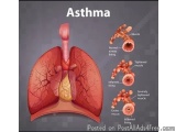 Top Asthma Care Center In India For Accurate Diagnosis And Treatm...