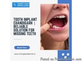 Tooth Implant Chandigarh Reliable Solution For Missing Teeth