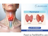 Best Robotic Thyroid Surgeon in Bangalore - Dr. Sumit Talwar