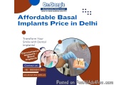 Affordable Basal Implants Price In Delhi At Dr. Garg’s Multispeci...
