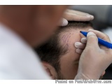 The image shows a close-up of a man's head being examined by a doctor. The doctor is wearing a white coat and gloves and is h...