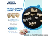 Natural Looking Dental Crowns At Dr. Garg’s Multispeciality Denta...