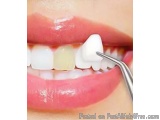The image shows a close-up of a person's mouth with a dental tool inserted into their teeth. The toothbrush is white and appe...
