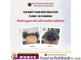 The Best Hair Transplant Clinic in Chennai