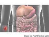 The image is a 3D illustration of the internal structure of the human body, specifically the large intestine and the small in...