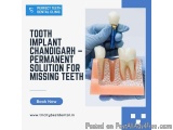 Tooth Implant Chandigarh – Permanent Solution For Missing Teeth
