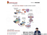CAR T Cell Therapy in Hyderabad: Expert Care by Dr. S.K. Gupta