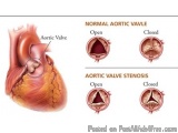 Experienced Heart Specialist Doctor In Jaipur – Dr. Ravinder Sing...