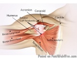 The image is a cross-section of the shoulder joint, showing the location of the acromion, coracoid, and clavicle. The image i...