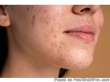 The image is a close-up of a woman's face. She appears to be in her late twenties or early thirties. Her skin is fair and her...