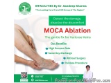 Best Doctor for Varicose Veins â€“ Expert Treatment for Healthy Legs