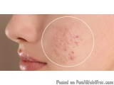 Say Goodbye to Skin Issues with Homeopathy Treatment