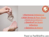 Understanding Hair Loss: Causes, Symptoms & When to Seek Treatment
