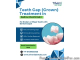 Teeth Cap (crown) Treatment In Badhra | Triveni Dental