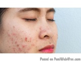 Natural Skin Care with Homeopathy Doctor in Gaur City