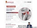Lymphoma Dr Near Me â€“ Consult Dr. S.K. Gupta for Expert Care