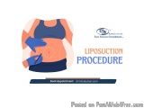 Fat Removal & Body Sculpting | Book Your Liposuction Now
