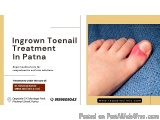 Ingrown Toenail Care Now Available in Phulwari Sharif Patna