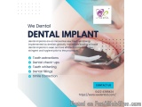 Dental implants in Coimbatore