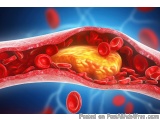 The image is a 3D illustration of a blood vessel with a yellow blood cell in the center. The blood vessel is surrounded by re...