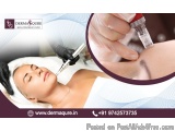 Complete Price Guide For Glowing Skin With Microneedling Cost In...