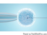 The image is a digital illustration of a sperm cell being injected into a sperm donor. The sperm cell is spherical in shape a...