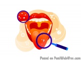 Safe and Personalized Mouth Cancer Treatment in Homeopathy