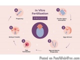 IVF Treatment Cost In Delhi - Dr Rhythm Gupta