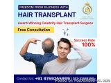 No.1 Hair Transplant Clinic in Thane at DNA Royal