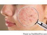 The image shows a close-up of a person's face, specifically their nose and upper lip. The person is holding a magnifying glas...