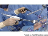 The image shows a group of surgeons performing an operation in an operating room. The surgeons are wearing blue surgical gown...