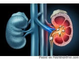 The image is a 3D illustration of a human kidney and a human lung. The kidney is shown on the left side of the image, with th...