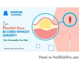 Can Pilonidal Sinus Be Cured Without Surgery? How Homeopathy Can Help