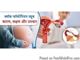 The image is an advertisement in Hindi that explains the concept of pregnancy. It shows a pregnant woman's belly with her han...