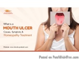 Symptoms of Mouth Ulcer and Homeopathic Medicine for Mouth Ulcer