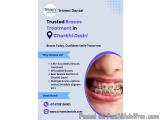 Affordable Braces Treatment In Charkhi Dadri | Triveni Dental