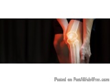 Naturopathy Treatment For Osteoarthritis for Improved Joint Function