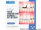 2 Front Teeth Veneers Cost In Mohali | Get Details
