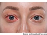 The image is a close-up of a person's face, specifically their eyes. The person has blue eyes and their eyebrows are neatly g...