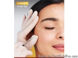 The image shows a close-up of a woman's face with her eyes closed. She is receiving a botox injection from a person wearing a...