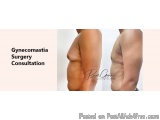 Gynecomastia Surgery Consultation Online – How To Prepare